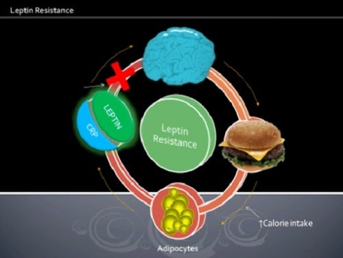 intermittent fasting and leptin resistance