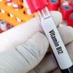 Best Vitamin Deficiency Test for You Best Vitamin Deficiency Test for You