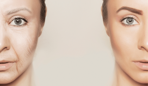 How To Find Your Biological Age And Decide Whether The Number Is Useful