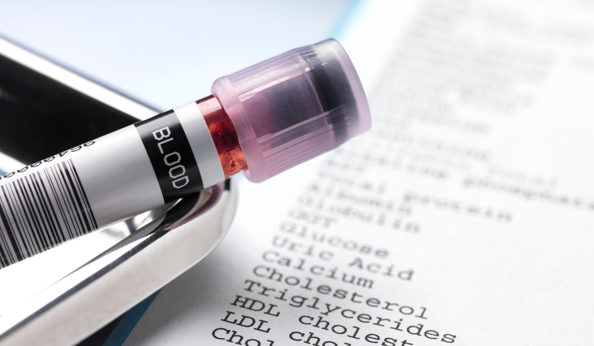 blood test results